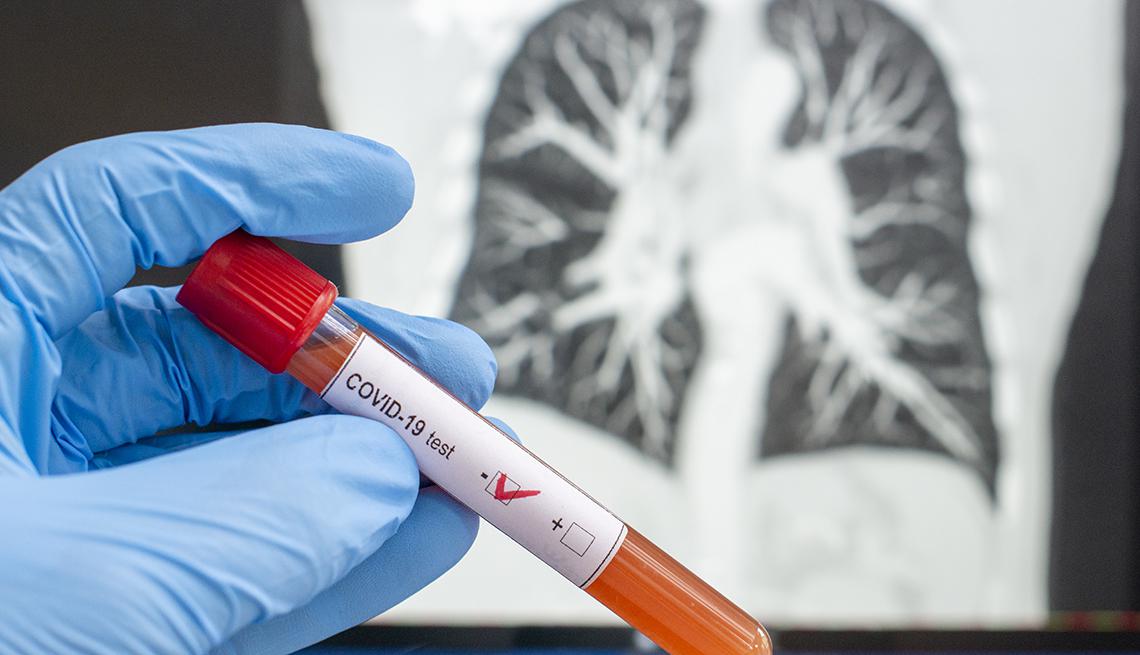 1140-lungs-covid-19-test-esp.imgcache.revc2d3c190b4ac645ede573056c28cb3c6