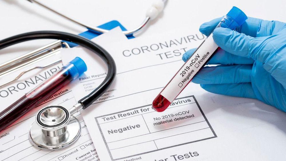 muestras-de-test-de-coronavirus-foto-freepik_15_1000x564