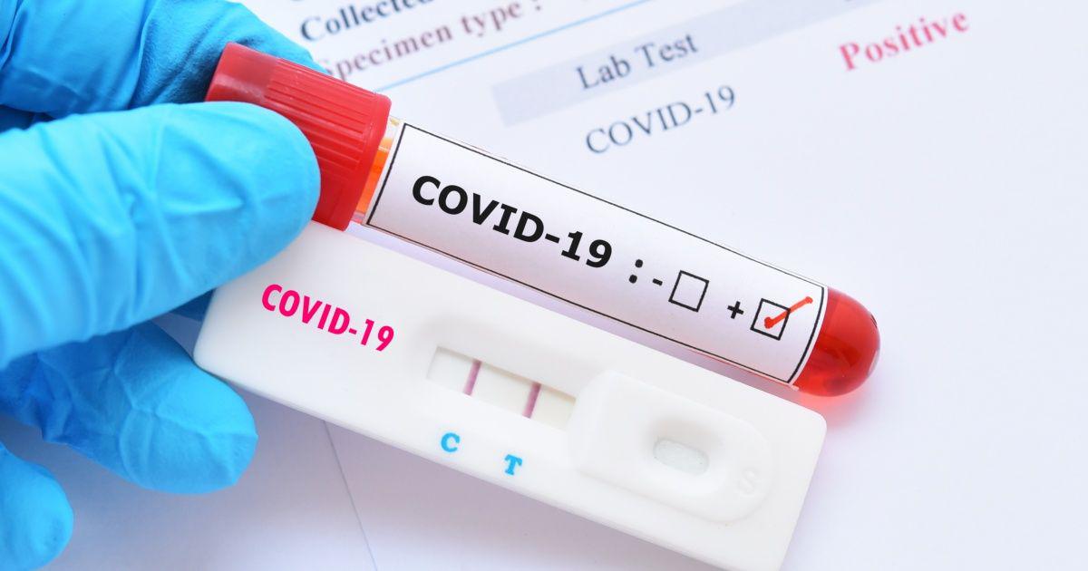 covid_19_coronavirus_shutterstock.jpg_673822677